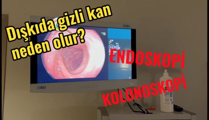 video,paylaşım,kameralı telefon,videofon,ücretsiz,yükleme